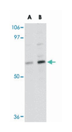 TMEM214 Rabbit anti-Human, Mouse, Rat, Polyclonal Antibody, Abnova 100&mu;g;