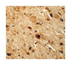 NKX3-2, Rabbit, Polyclonal Antibody, Abnova 100 &mu;g | Buy Online | Abnova | Fisher Scientific