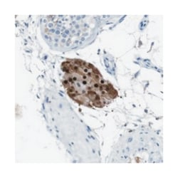 SLC2A8, Rabbit, Polyclonal Antibody, Abnova 100 &mu;L | Buy Online | Abnova Corporation | Fisher Scientific