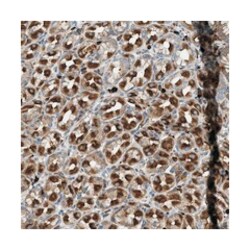 TMEM68 Rabbit anti-Human, Polyclonal Antibody, Abnova 100&mu;L; Unlabeled:Antibodies,