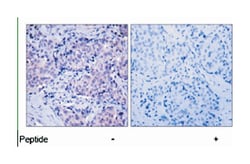 PDPK1 Rabbit anti-Human, Mouse, Rat, Polyclonal Antibody, Abnova 100 &mu;g | Buy Online | Abnova Corporation | Fisher Scientific