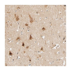 PDDC1, Rabbit, Polyclonal Antibody, Abnova 100 &mu;L | Buy Online | Abnova Corporation | Fisher Scientific