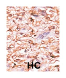 TP53 (phospho T18), Rabbit anti-Human, Mouse, Polyclonal Antibody, Abnova