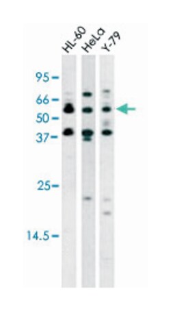 RAD9A (phospho S272), Rabbit anti-Human, Polyclonal Antibody, Abnova 400&mu;L;