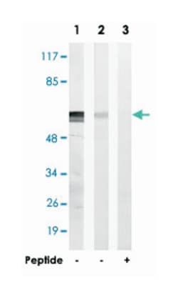 ATP5A1, Rabbit, Polyclonal Antibody, Abnova 100 &mu;g | Buy Online | Abnova | Fisher Scientific