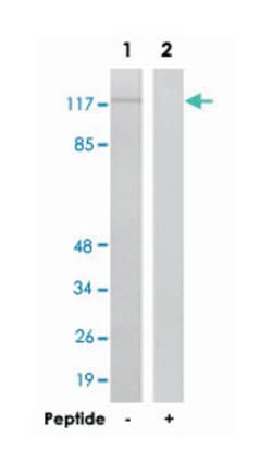 FGFR1 Rabbit anti-Human, Mouse, Rat, Polyclonal Antibody, Abnova 100&mu;g;