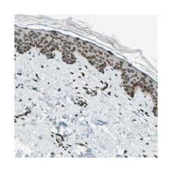 LEMD2 Rabbit anti-Human, Polyclonal Antibody, Abnova 100 &mu;L | Buy Online | Abnova | Fisher Scientific