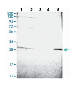 ERGIC1 Rabbit anti-Human, Polyclonal Antibody, Abnova 100&mu;L; Unlabeled:Antibodies,
