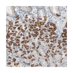 CBLB Rabbit anti-Human, Polyclonal Antibody, Abnova 100&mu;L; Unlabeled:Antibodies,