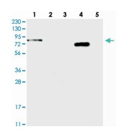 APEH Rabbit anti-Human, Polyclonal Antibody, Abnova 100&mu;L; Unlabeled:Antibodies,