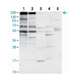 ZNF646, Rabbit, Polyclonal Antibody, Abnova 100 &mu;L | Buy Online | Abnova Corporation | Fisher Scientific