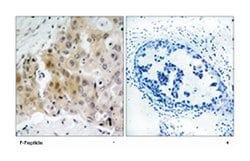 KDR (phospho Y1175), Rabbit anti-Human, Mouse, Rat, Polyclonal Antibody,