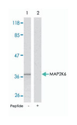 MAP2K6 Rabbit anti-Human, Rat, Polyclonal Antibody, Abnova 100 &mu;g | Buy Online | Abnova Corporation | Fisher Scientific