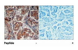 MTOR Rabbit anti-Human, Mouse, Rat, Polyclonal Antibody, Abnova 100&mu;g;