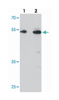 TMEM135, Rabbit, Polyclonal Antibody, Abnova 100&mu;g; Unlabeled:Antibodies,