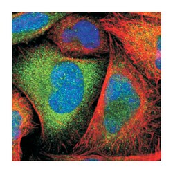 TXNRD1 Rabbit anti-Human, Polyclonal Antibody, Abnova 100&mu;L; Unlabeled:Antibodies,