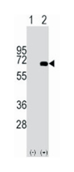 AFP Rabbit anti-Human, Polyclonal Antibody, Abnova 400 &mu;L | Buy Online | Abnova Corporation | Fisher Scientific