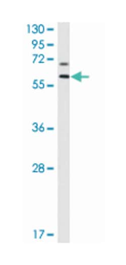 MMP17 Rabbit anti-Human, Polyclonal Antibody, Abnova 400&mu;L; Unlabeled:Antibodies,