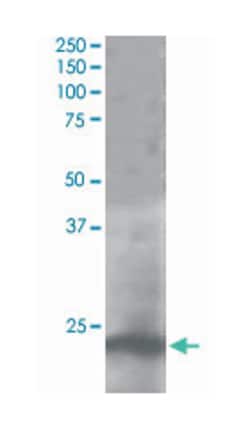 PLDN, Goat, Polyclonal Antibody, Abnova 100 &mu;g | Buy Online | Abnova Corporation | Fisher Scientific