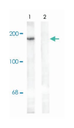Grin2b (phospho Y1336), Rabbit anti-Human, Mouse, Rat, Polyclonal Antibody,