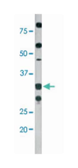 CDK2 (phospho T160), Rabbit anti-Human, Polyclonal Antibody, Abnova 400 &mu;L | Buy Online | Abnova | Fisher Scientific