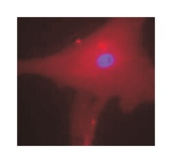 MLXIPL Rabbit anti-Human, Mouse, Polyclonal Antibody, Abnova 100 &mu;L | Buy Online | Abnova Corporation | Fisher Scientific