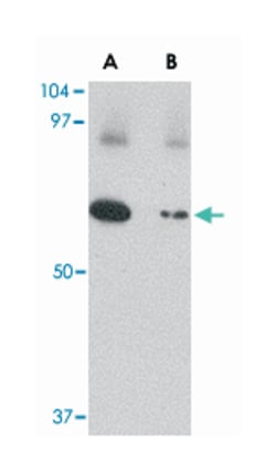 SLC22A17 Rabbit anti-Human, Mouse, Rat, Polyclonal Antibody, Abnova 100&mu;g;