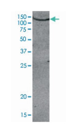 AOF2 Rabbit anti-Human, Polyclonal Antibody, Abnova 50&mu;g; Unlabeled:Antibodies,