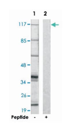 ST18 Rabbit anti-Human, Polyclonal Antibody, Abnova 100&mu;g; Unlabeled:Antibodies,