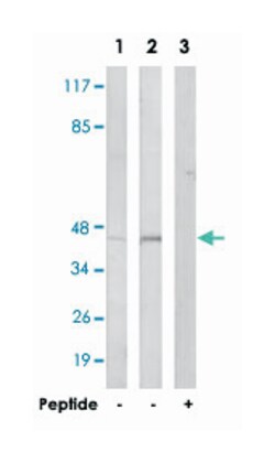 GCNT6, Rabbit, Polyclonal Antibody, Abnova 100&mu;g; Unlabeled:Antibodies,