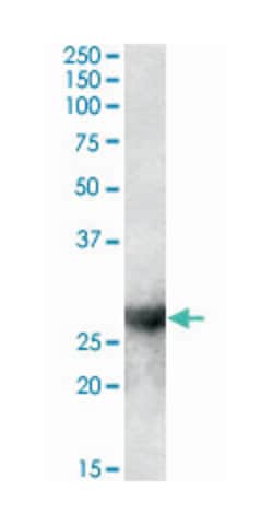 LGALS3, Goat, Polyclonal Antibody, Abnova 100 &mu;g | Buy Online | Abnova Corporation | Fisher Scientific