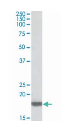 PTN, Goat, Polyclonal Antibody, Abnova 100&mu;g; Unlabeled:Anticuerpos