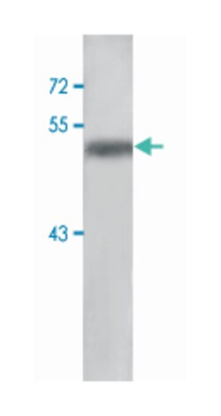 GLRA1, Rabbit, Polyclonal Antibody, Abnova 100&mu;g; Unlabeled:Antibodies,