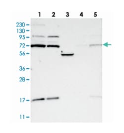 KLHL6, Rabbit, Polyclonal Antibody, Abnova 100&mu;L; Unlabeled:Antibodies,