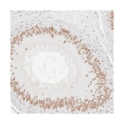 LARP7 Rabbit anti-Human, Polyclonal Antibody, Abnova 100 &mu;L | Buy Online | Abnova Corporation | Fisher Scientific