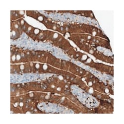 ANKRD34A Rabbit anti-Human, Mouse, Rat, Polyclonal Antibody, Abnova 100 &mu;L | Buy Online | Abnova Corporation | Fisher Scientific