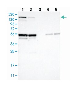 OFD1 Rabbit anti-Human, Polyclonal Antibody, Abnova 100 &mu;L | Buy Online | Abnova | Fisher Scientific