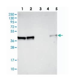 PRAMEF12, Rabbit, Polyclonal Antibody, Abnova 100 &mu;L | Buy Online | Abnova Corporation | Fisher Scientific