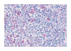 P2RY10, Rabbit, Polyclonal Antibody, Abnova 50 &mu;g | Buy Online | Abnova Corporation | Fisher Scientific