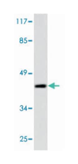 E2F4/E2F5, Rabbit, Polyclonal Antibody, Abnova 100 &mu;L | Buy Online | Abnova | Fisher Scientific
