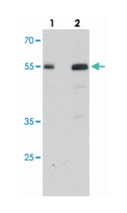 SDPR, Rabbit, Polyclonal Antibody, Abnova 100&mu;g; Unlabeled:Antibodies,
