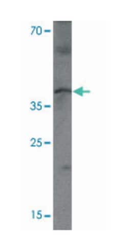 MTERFD3, Rabbit, Polyclonal Antibody, Abnova 100 &mu;g | Buy Online | Abnova Corporation | Fisher Scientific