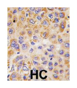 PFKFB1 Rabbit anti-Human, Polyclonal Antibody, Abnova 400&mu;L; Unlabeled:Antibodies,