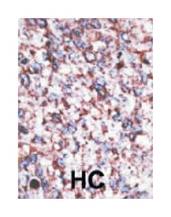 BACE2 Rabbit anti-Human, Polyclonal Antibody, Abnova 400&mu;L; Unlabeled:Antibodies,