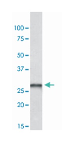 PGAM1/PGAM2/PGAM4, Goat, Polyclonal Antibody, Abnova 100&mu;g; Unlabeled:Antibodies,
