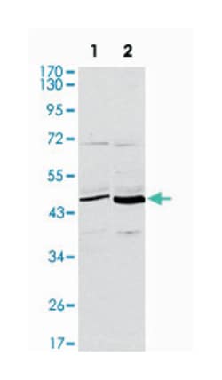 CD86, Mouse, Clone: 1B3, Abnova 100&mu;L; Unlabeled:Antibodies, Monoclonal