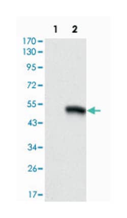 CD9, Mouse, Clone: 5G6, Abnova 100&mu;L; Unlabeled:Antibodies, Monoclonal