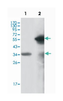 MLL, Mouse, Clone: 10F8D7, Abnova 100&mu;L; Unlabeled:Antibodies, Monoclonal