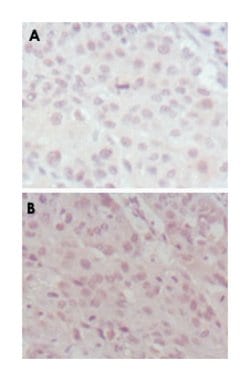 MLL, Mouse, Clone: 10F8D7, Abnova 100&mu;L; Unlabeled:Antibodies, Monoclonal