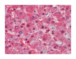 LPA, Mouse, Clone: 8F6A9, 8H5C5, Abnova 100&mu;L; Unlabeled:Antibodies,